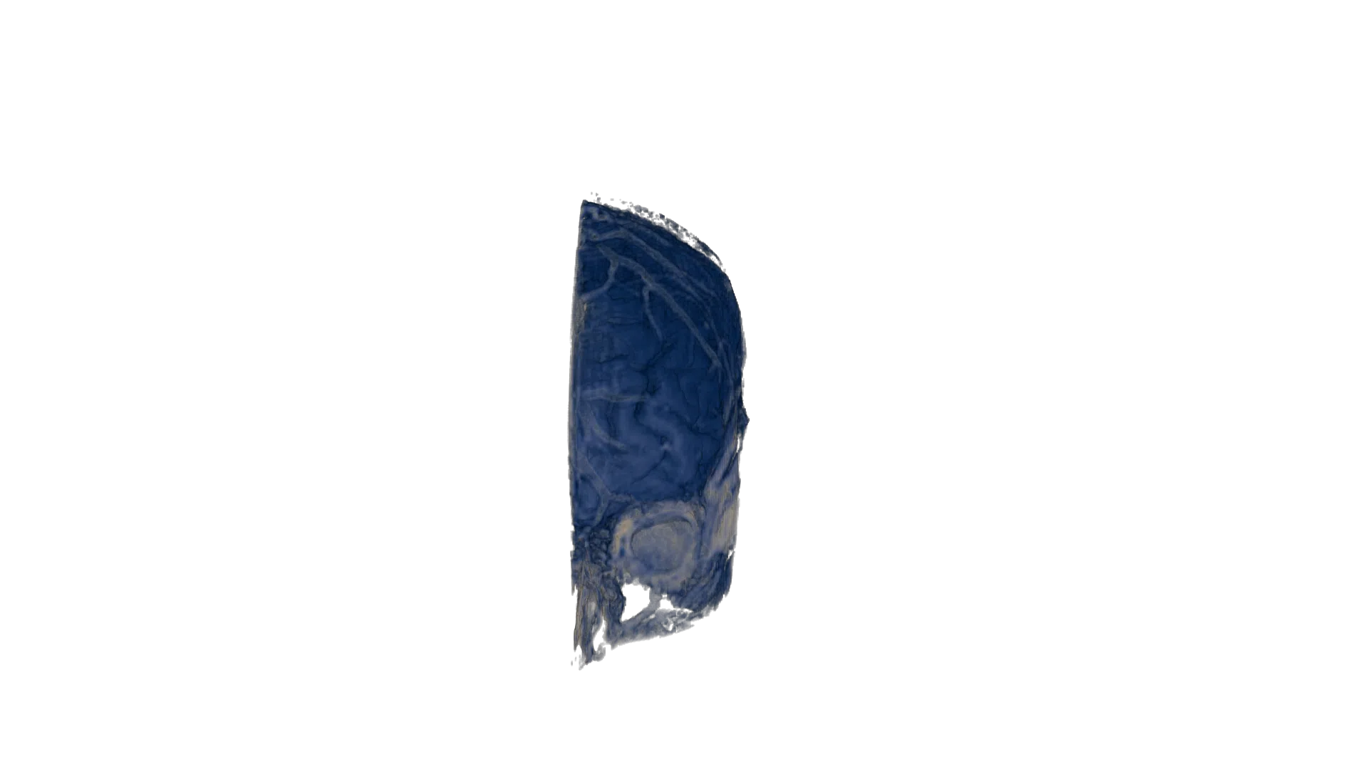 Turntable animation of the right half of the CT head tumor example rendered in color_rgba