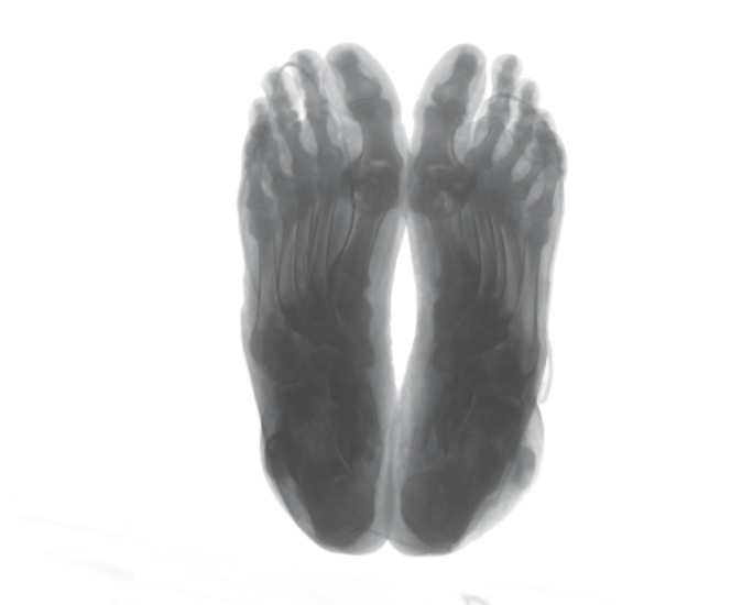Bottom-view real CT scan of feet