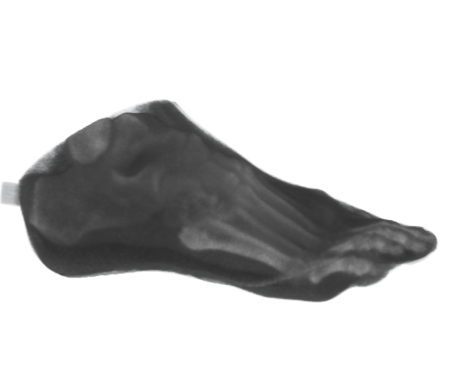 Side-view CT scan of the printed and scanned feet phantom
