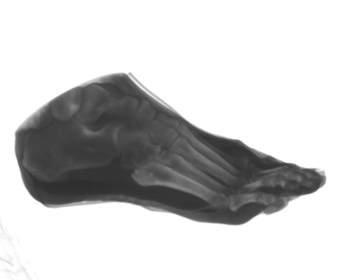 Side-view real CT scan of feet