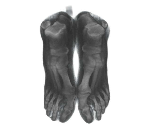 Top-view CT scan of the printed and scanned feet phantom