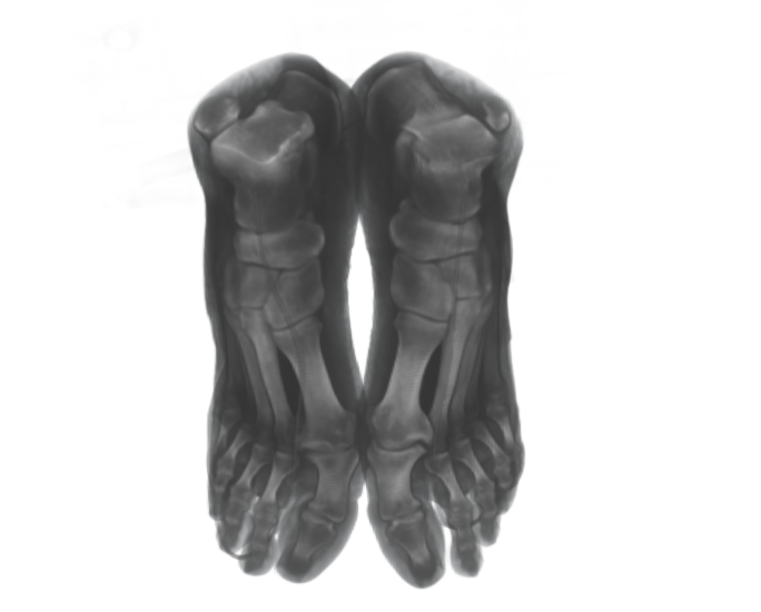 Top-view real CT scan of feet